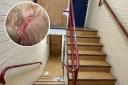 Toddler airlifted to hospital and left with nine staples in head after stairwell fall