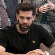 Towie's Charlie King has called for more mental health support for people undergoing cosmetic surgery