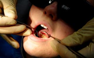 Dozens of children in Southend and Basildon admitted to hospital to have rotten teeth removed