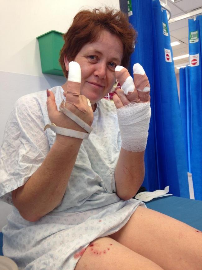 Linda McCall was attacked by a Staffie